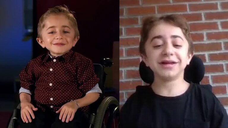 Kaleb from the Shriners commercials is all grown up and answering 7 Questions with Emmy